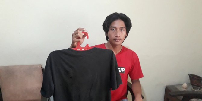 Korban Begal Shendy Sempat Dibacok Dan Dibuang